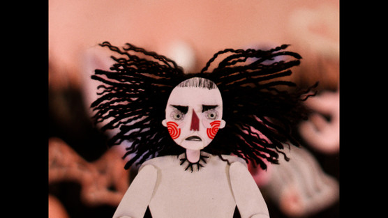 PHOTOGRAPH OF AN INSANE WOMAN TO SHOW THE CONDITION OF HER HAIR